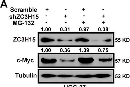 ZC3H15 Antibody - BSA Free