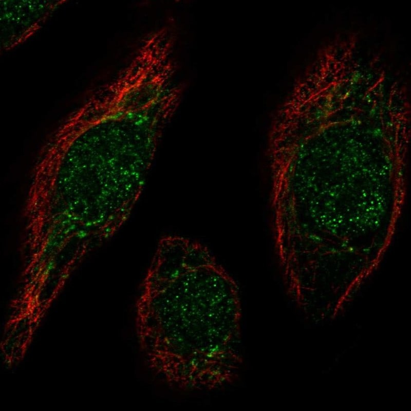 MafB Antibody - BSA Free Immunocytochemistry/ Immunofluorescence: MafB Antibody [NBP1-81342]