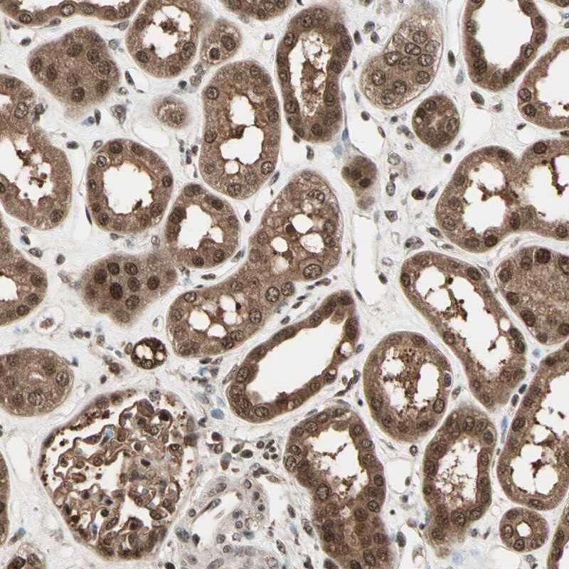 ZNF44 Antibody - BSA Free Immunohistochemistry-Paraffin: ZNF44 Antibody [NBP1-81344]