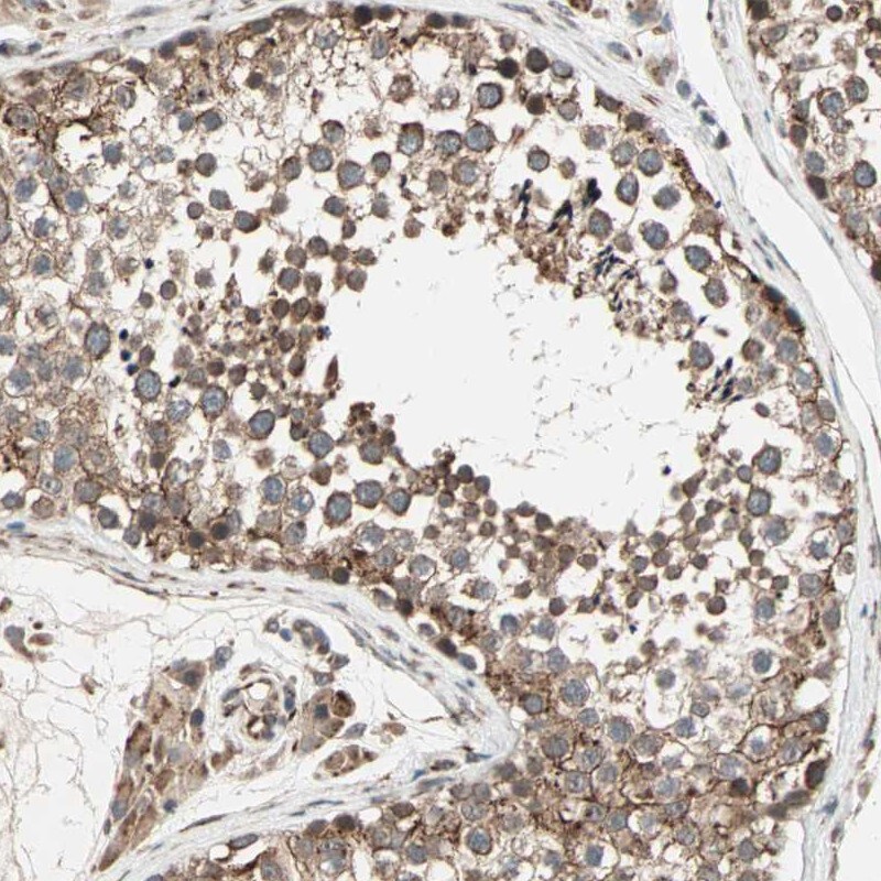 ZNF37A Antibody - BSA Free Immunohistochemistry-Paraffin: ZNF37A Antibody [NBP1-81345]