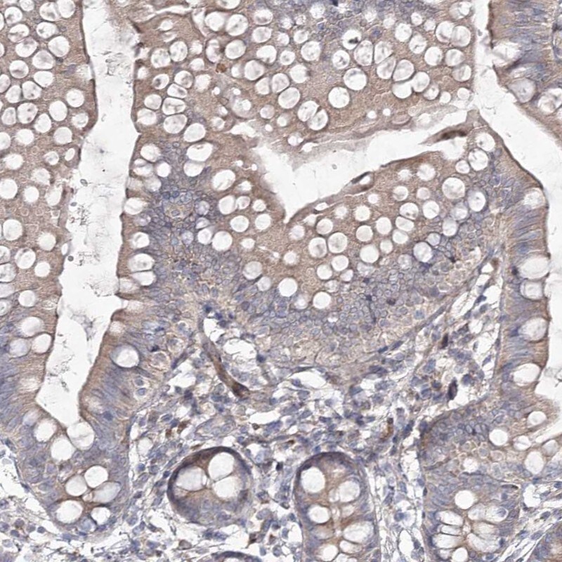 CIB2 Antibody - BSA Free Immunohistochemistry-Paraffin: CIB2 Antibody [NBP1-81351]