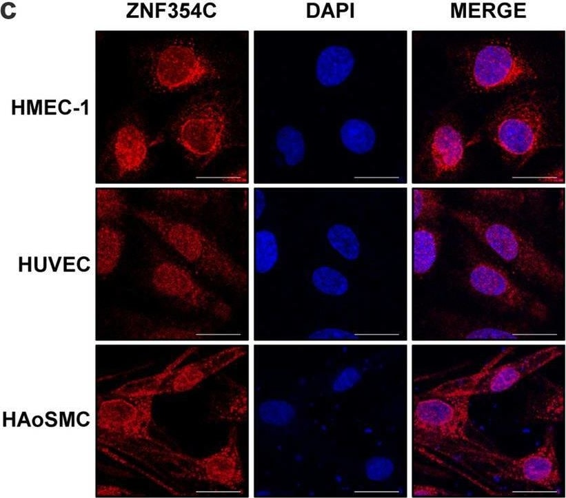 ZNF354C Antibody - BSA Free