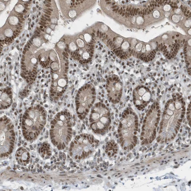 YTHDC1 Antibody - BSA Free Immunohistochemistry-Paraffin: YTHDC1 Antibody [NBP1-81353]