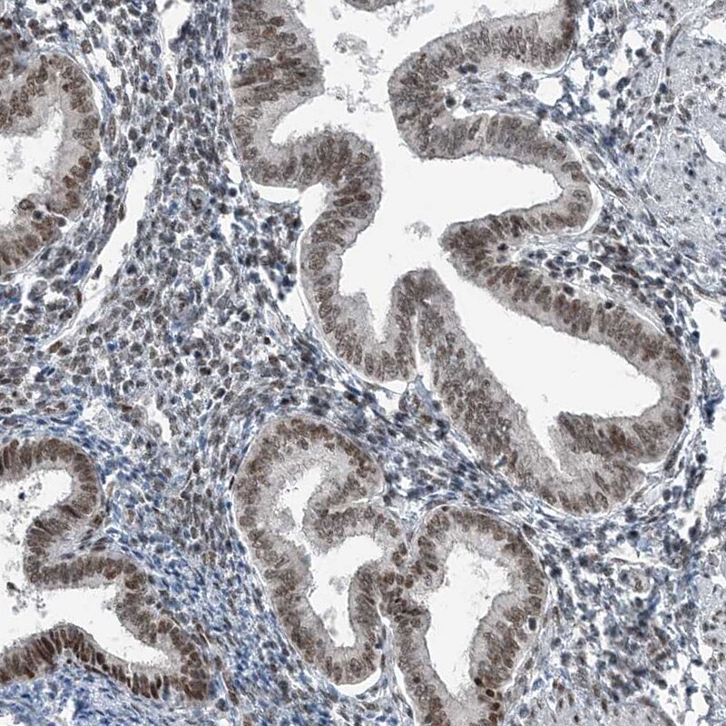 YTHDC1 Antibody - BSA Free Immunohistochemistry-Paraffin: YTHDC1 Antibody [NBP1-81353]