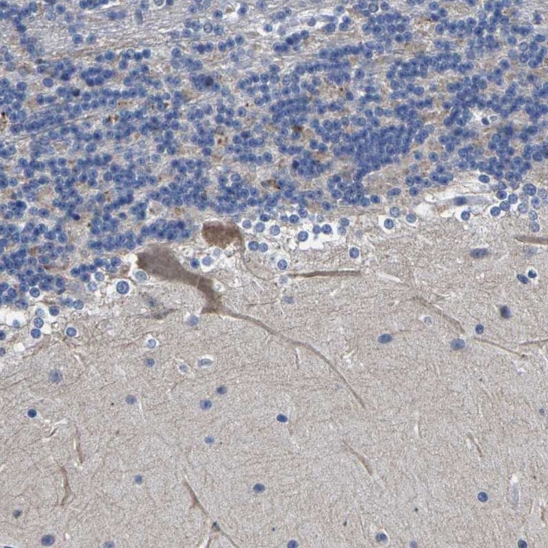 ST6 Gal Sialyltransferase 2/ST6GAL2 Antibody - BSA Free Immunohistochemistry: ST6 Gal Sialyltransferase 2/ST6GAL2 Antibody - BSA Free [NBP1-81364]