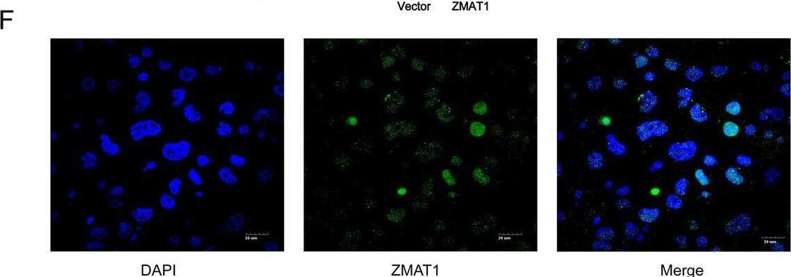 ZMAT1 Antibody - BSA Free