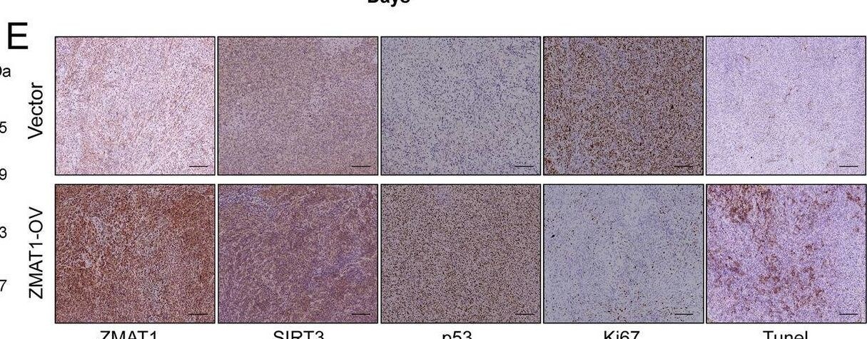 ZMAT1 Antibody - BSA Free