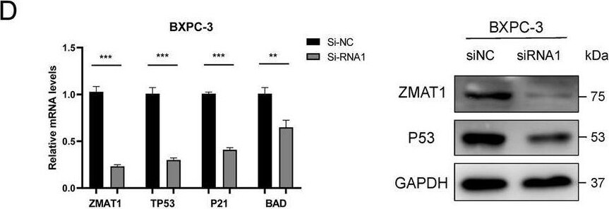 ZMAT1 Antibody - BSA Free
