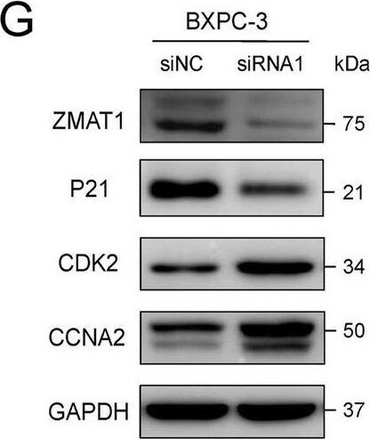 ZMAT1 Antibody - BSA Free