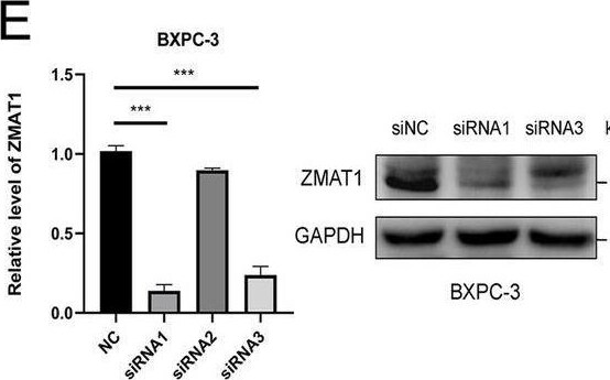 ZMAT1 Antibody - BSA Free