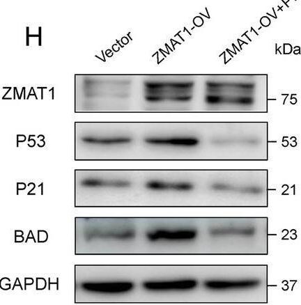 ZMAT1 Antibody - BSA Free