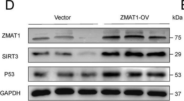 ZMAT1 Antibody - BSA Free