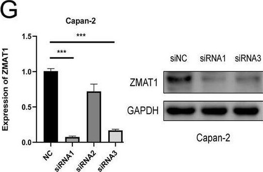 ZMAT1 Antibody - BSA Free
