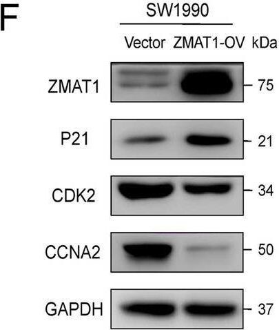 ZMAT1 Antibody - BSA Free