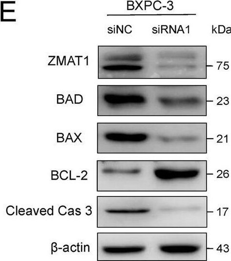 ZMAT1 Antibody - BSA Free