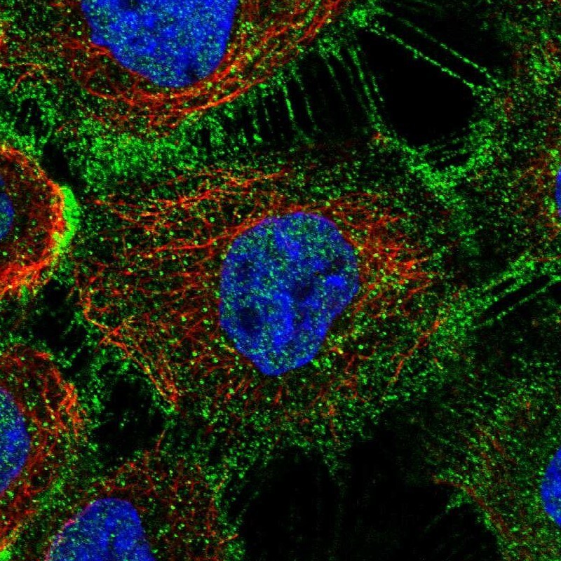 ZDHHC5 Antibody - BSA Free Immunocytochemistry/ Immunofluorescence: ZDHHC5 Antibody [NBP1-81376]