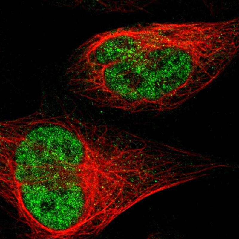 JHDM1D Antibody - BSA Free Immunocytochemistry/ Immunofluorescence: JHDM1D Antibody [NBP1-81382]