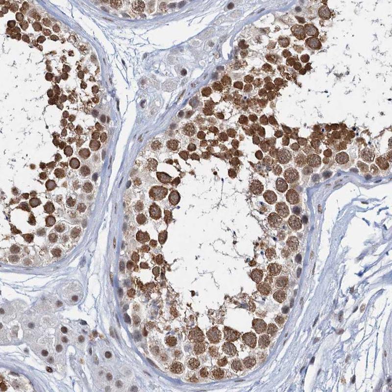 METTL14 Antibody - BSA Free Immunohistochemistry-Paraffin: METTL14 Antibody [NBP1-81392]