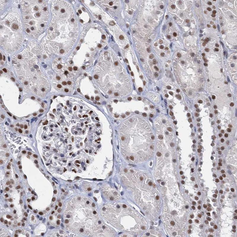 METTL14 Antibody - BSA Free Immunohistochemistry-Paraffin: METTL14 Antibody [NBP1-81392]