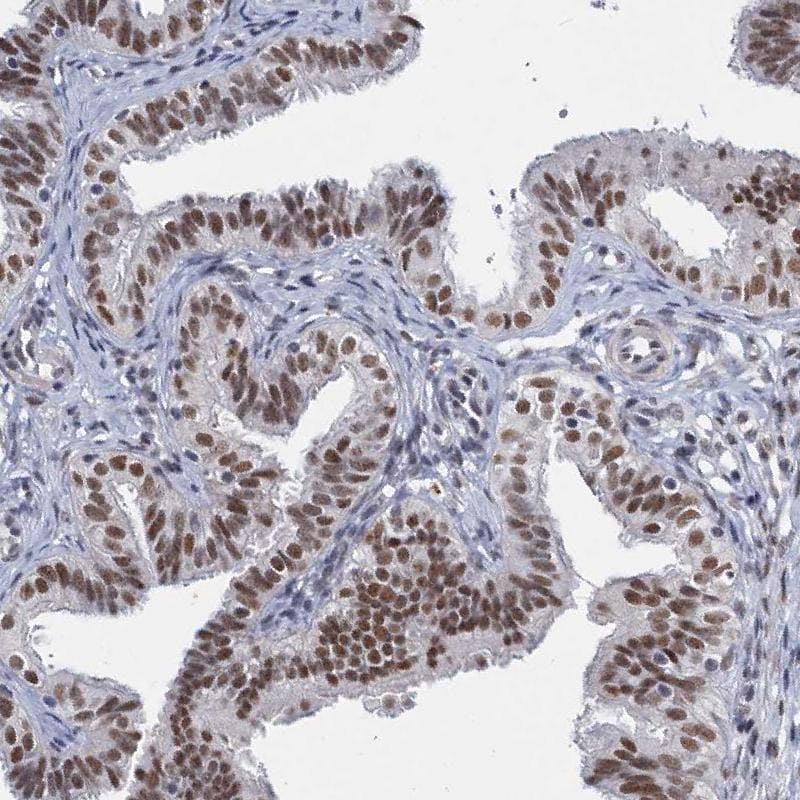 METTL14 Antibody - BSA Free Immunohistochemistry-Paraffin: METTL14 Antibody [NBP1-81392]