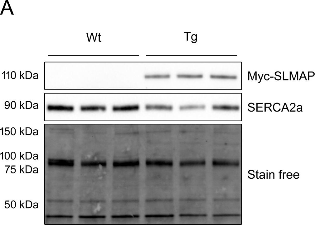 SLMAP Antibody