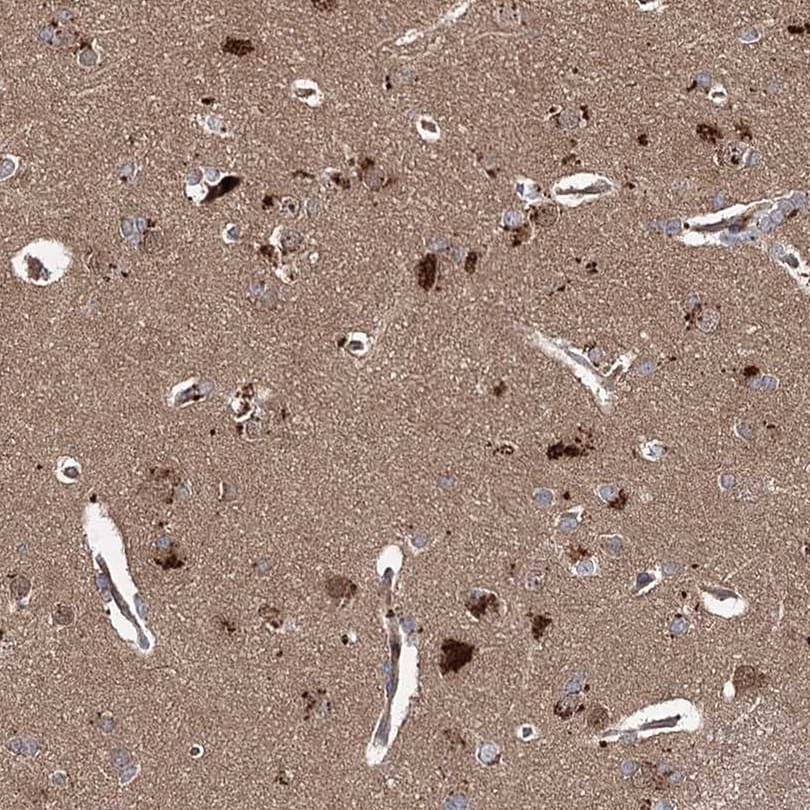 UAF1/WDR48 Antibody - BSA Free Immunohistochemistry-Paraffin: UAF1/WDR48 Antibody [NBP1-81404]