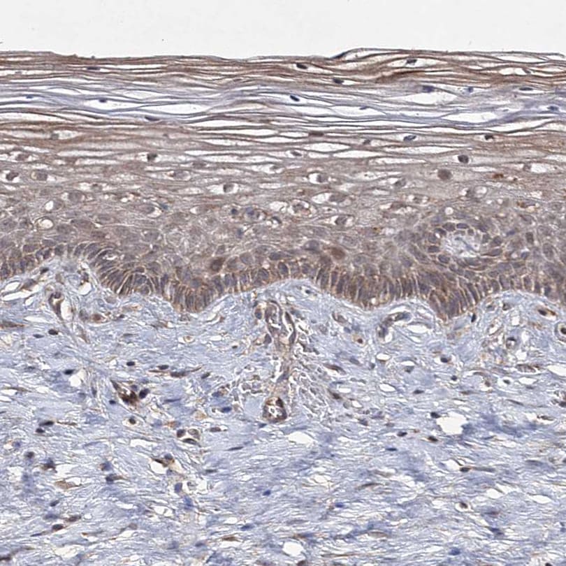 UAF1/WDR48 Antibody - BSA Free Immunohistochemistry-Paraffin: UAF1/WDR48 Antibody [NBP1-81404]