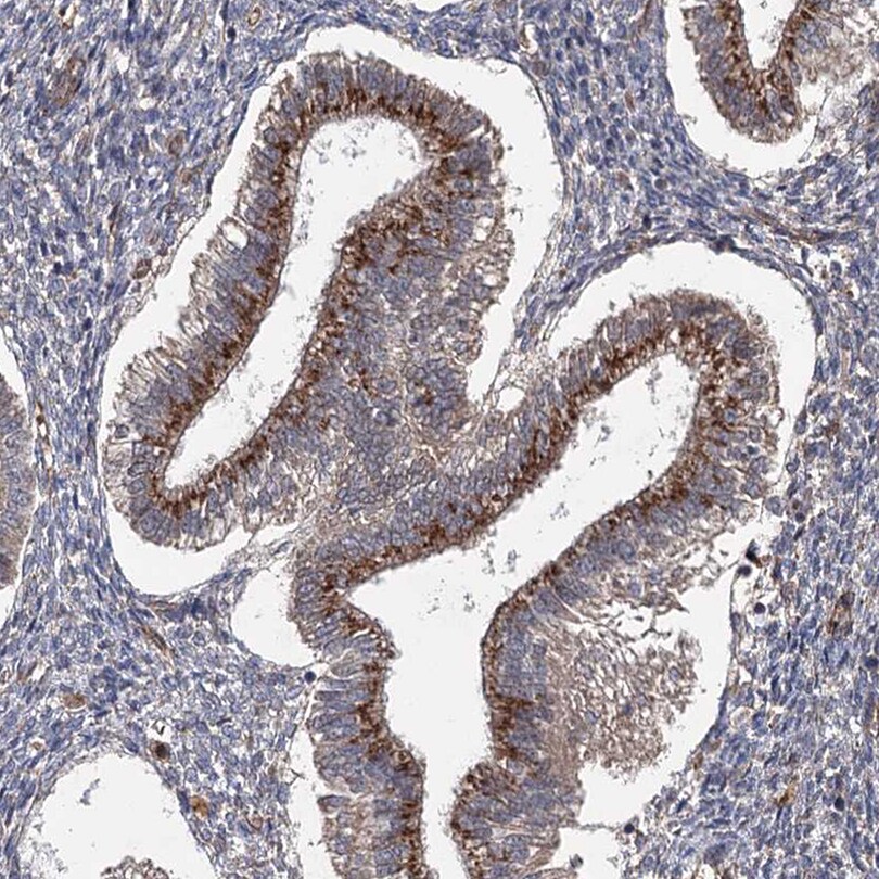 UAF1/WDR48 Antibody - BSA Free Immunohistochemistry-Paraffin: UAF1/WDR48 Antibody [NBP1-81404]