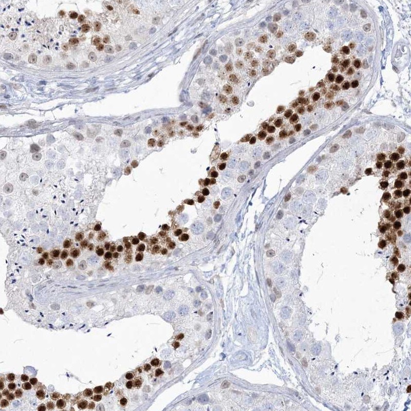 Homez Antibody - BSA Free Immunohistochemistry-Paraffin: Homez Antibody [NBP1-81405]