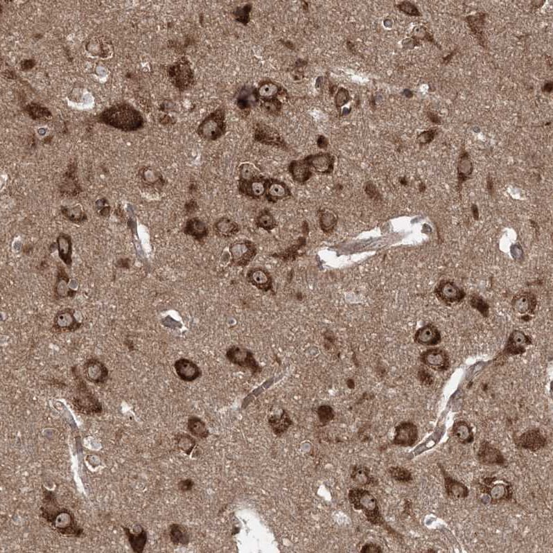 SERINC1 Antibody - BSA Free Immunohistochemistry-Paraffin: SERINC1 Antibody [NBP1-81423]