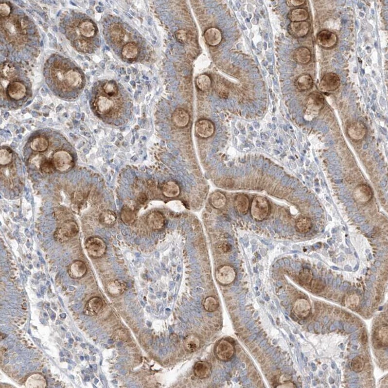 ADAMTSL3 Antibody - BSA Free Immunohistochemistry: ADAMTSL3 Antibody - BSA Free [NBP1-81426]
