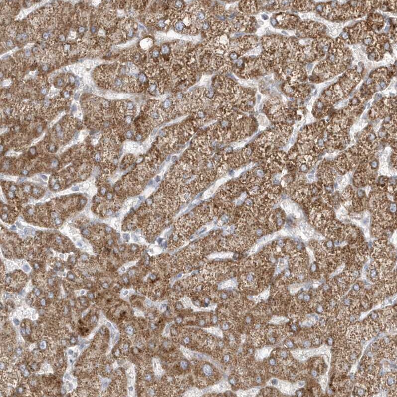 ADAMTSL3 Antibody - BSA Free Immunohistochemistry: ADAMTSL3 Antibody - BSA Free [NBP1-81426]