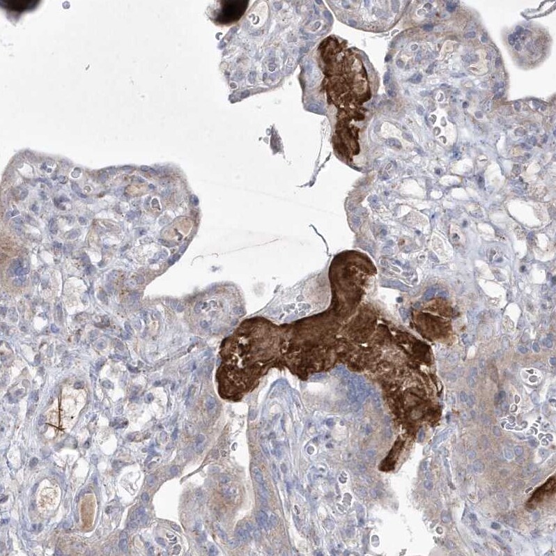 ADAMTSL3 Antibody - BSA Free Immunohistochemistry: ADAMTSL3 Antibody - BSA Free [NBP1-81426]
