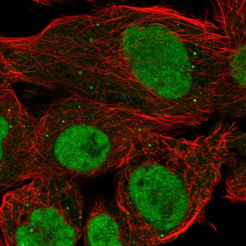 PRDM10 Antibody - BSA Free Immunocytochemistry/ Immunofluorescence: PRDM10 Antibody [NBP1-81427]