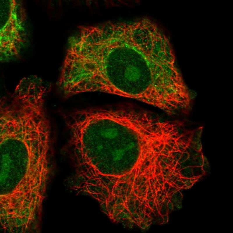 GRAMD1B Antibody - BSA Free Immunocytochemistry/ Immunofluorescence: GRAMD1B Antibody [NBP1-81431]