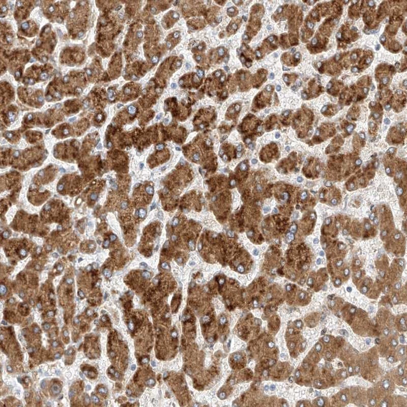 PCYOX1 Antibody - BSA Free Immunohistochemistry: PCYOX1 Antibody - BSA Free [NBP1-81462]
