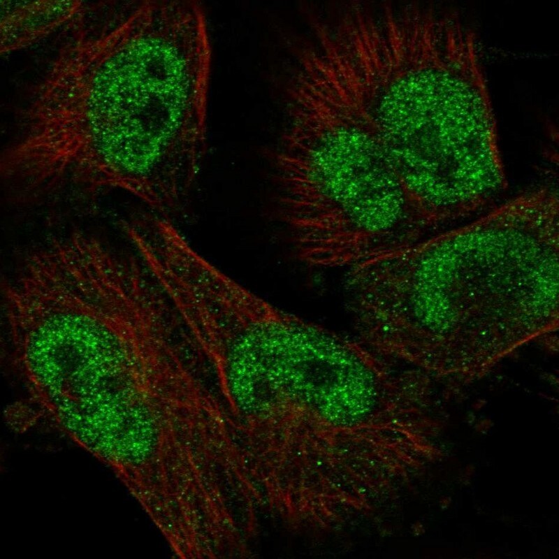 UBOX5 Antibody - BSA Free Immunocytochemistry/ Immunofluorescence: UBOX5 Antibody [NBP1-81469]