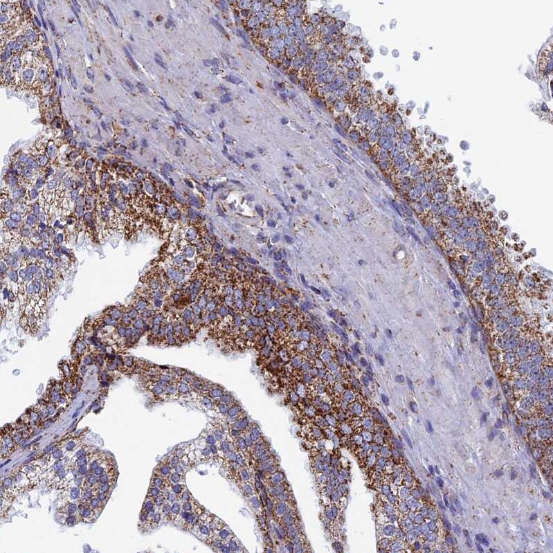 SEC24D Antibody - BSA Free Immunohistochemistry: SEC24D Antibody - BSA Free [NBP1-81482]