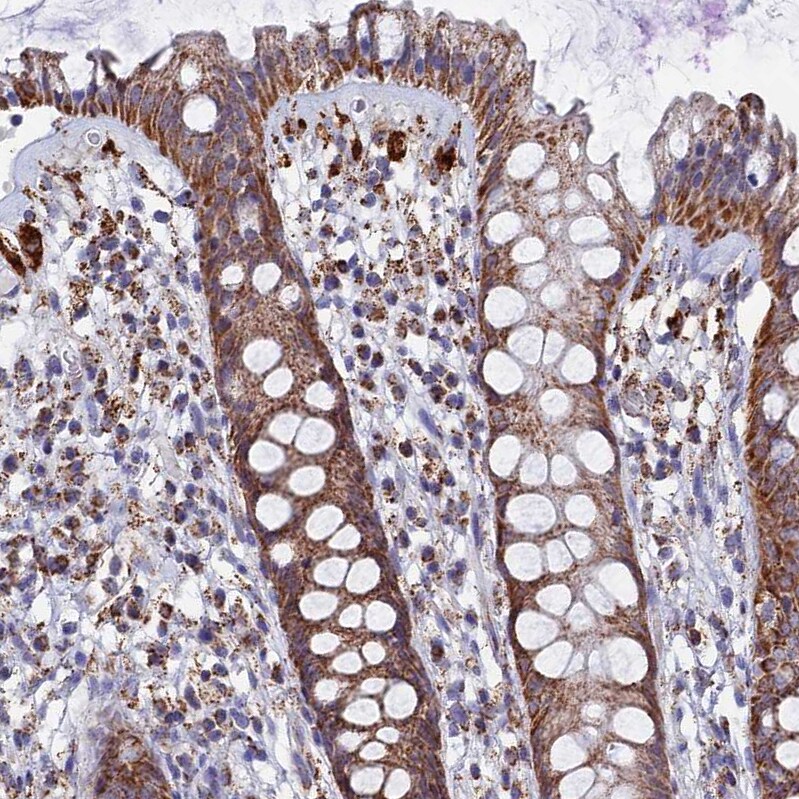 SEC24D Antibody - BSA Free Immunohistochemistry: SEC24D Antibody - BSA Free [NBP1-81482]