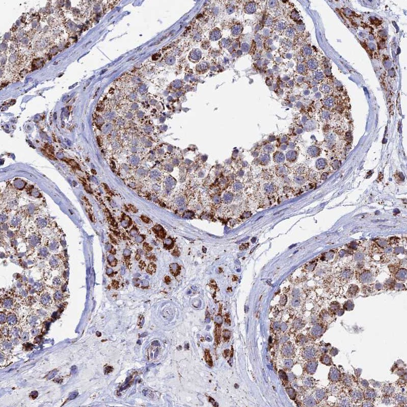 SEC24D Antibody - BSA Free Immunohistochemistry: SEC24D Antibody - BSA Free [NBP1-81482]