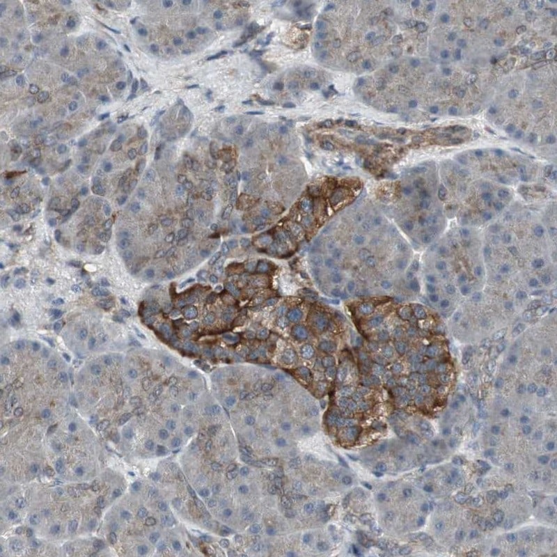 CCL15/MIP-1 delta Antibody Immunohistochemistry: CCL15/MIP-1 delta Antibody [NBP1-80957]