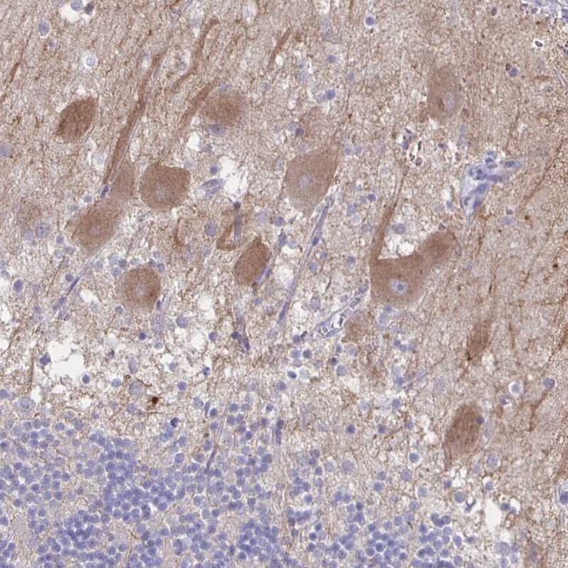 CACNA2D2 Antibody - BSA Free Immunohistochemistry-Paraffin: CACNA2D2 Antibody [NBP1-81501]