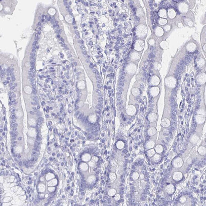 CACNA2D2 Antibody - BSA Free Immunohistochemistry-Paraffin: CACNA2D2 Antibody [NBP1-81501]