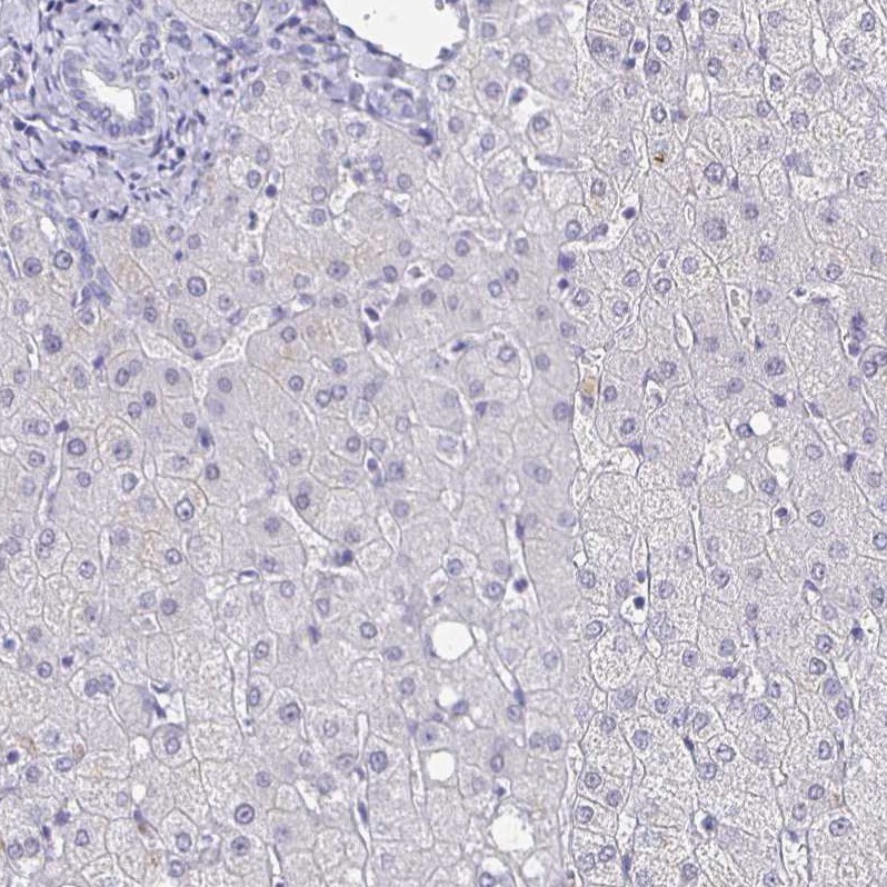 CACNA2D2 Antibody - BSA Free Immunohistochemistry-Paraffin: CACNA2D2 Antibody [NBP1-81501]