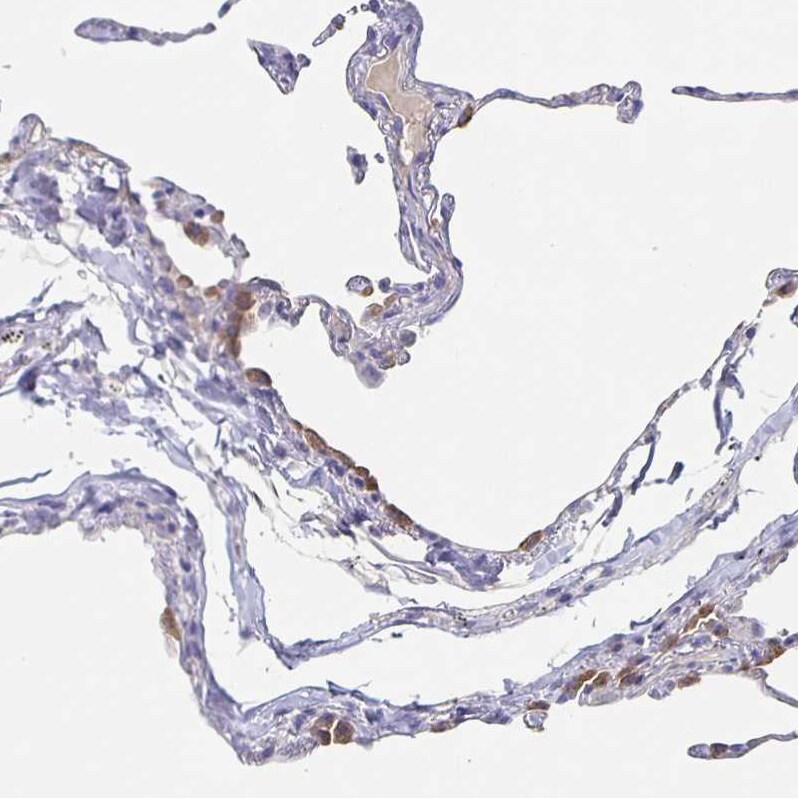 CACNA2D2 Antibody - BSA Free Immunohistochemistry-Paraffin: CACNA2D2 Antibody [NBP1-81501]