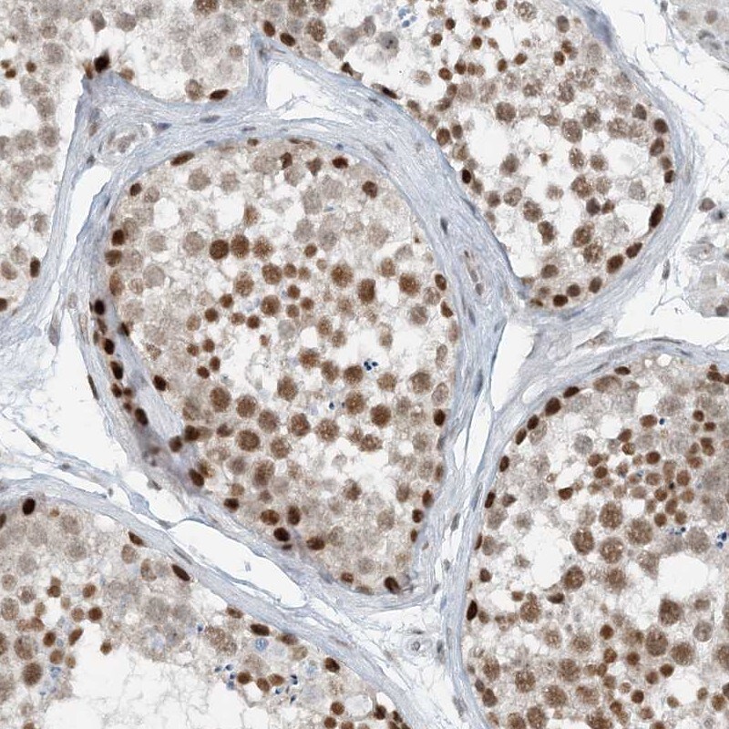 ZNF500 Antibody - BSA Free Immunohistochemistry-Paraffin: ZNF500 Antibody [NBP1-81502]