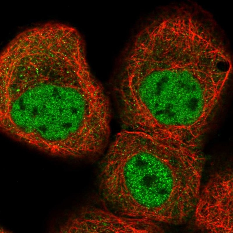 KLHDC10 Antibody - BSA Free Immunocytochemistry/ Immunofluorescence: KLHDC10 Antibody [NBP1-81528]
