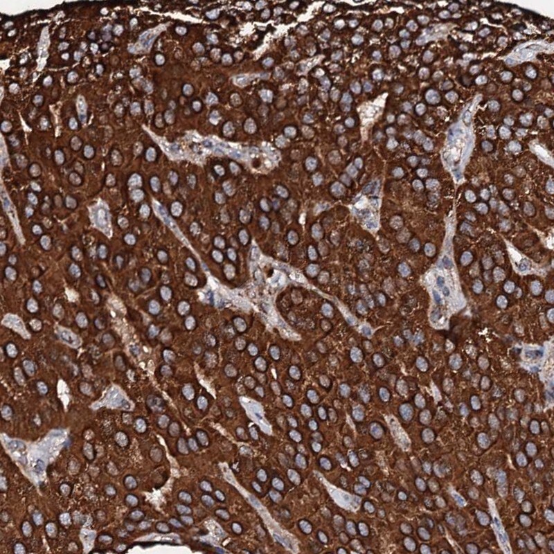 SECISBP2L Antibody - BSA Free Immunohistochemistry-Paraffin: SECISBP2L Antibody [NBP1-81530]