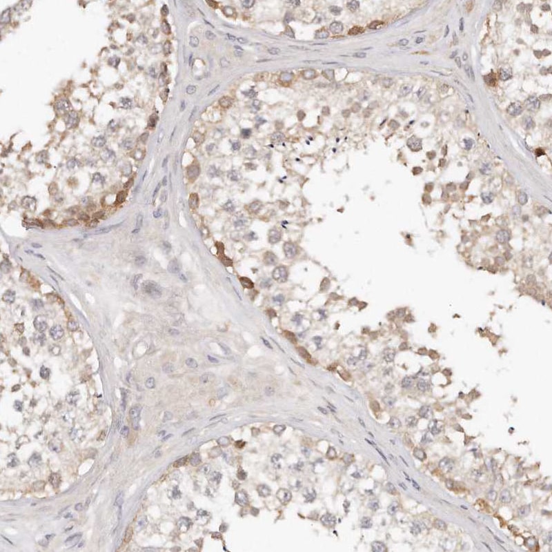 TTLL4 Antibody - BSA Free Immunohistochemistry-Paraffin: TTLL4 Antibody [NBP1-81535]