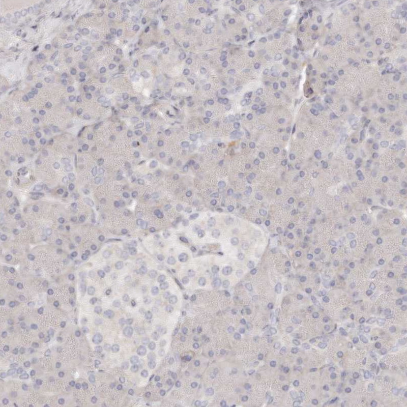 TTLL4 Antibody - BSA Free Immunohistochemistry-Paraffin: TTLL4 Antibody [NBP1-81535]